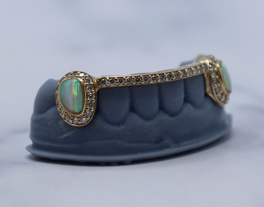 Custom Dental Grillz