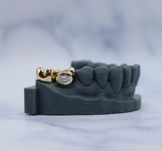 Permanent Diamond Teeth Implants